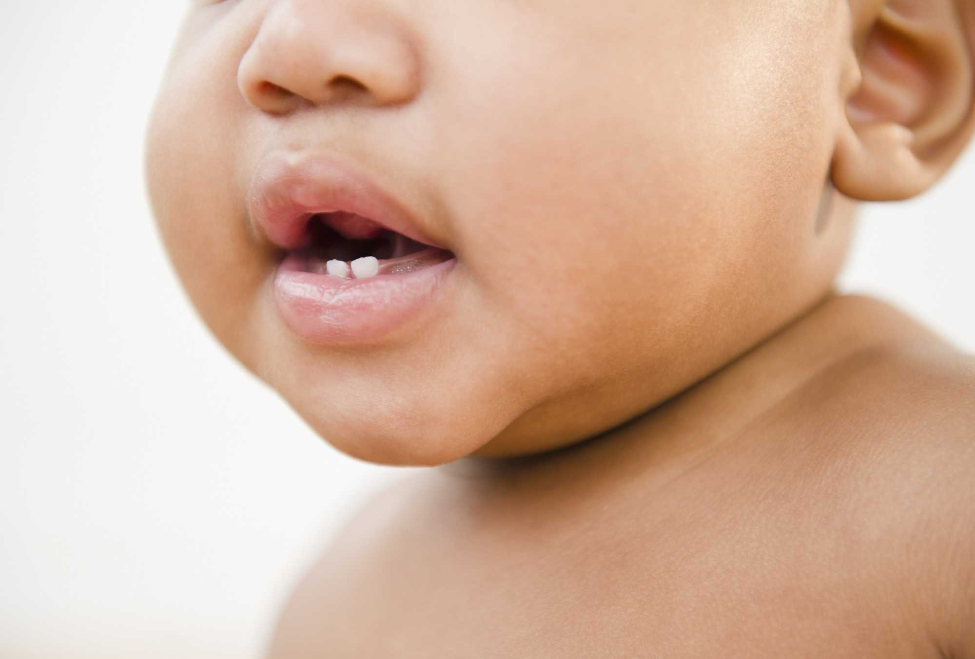 Jak uklidnit dítě když rostou zuby?